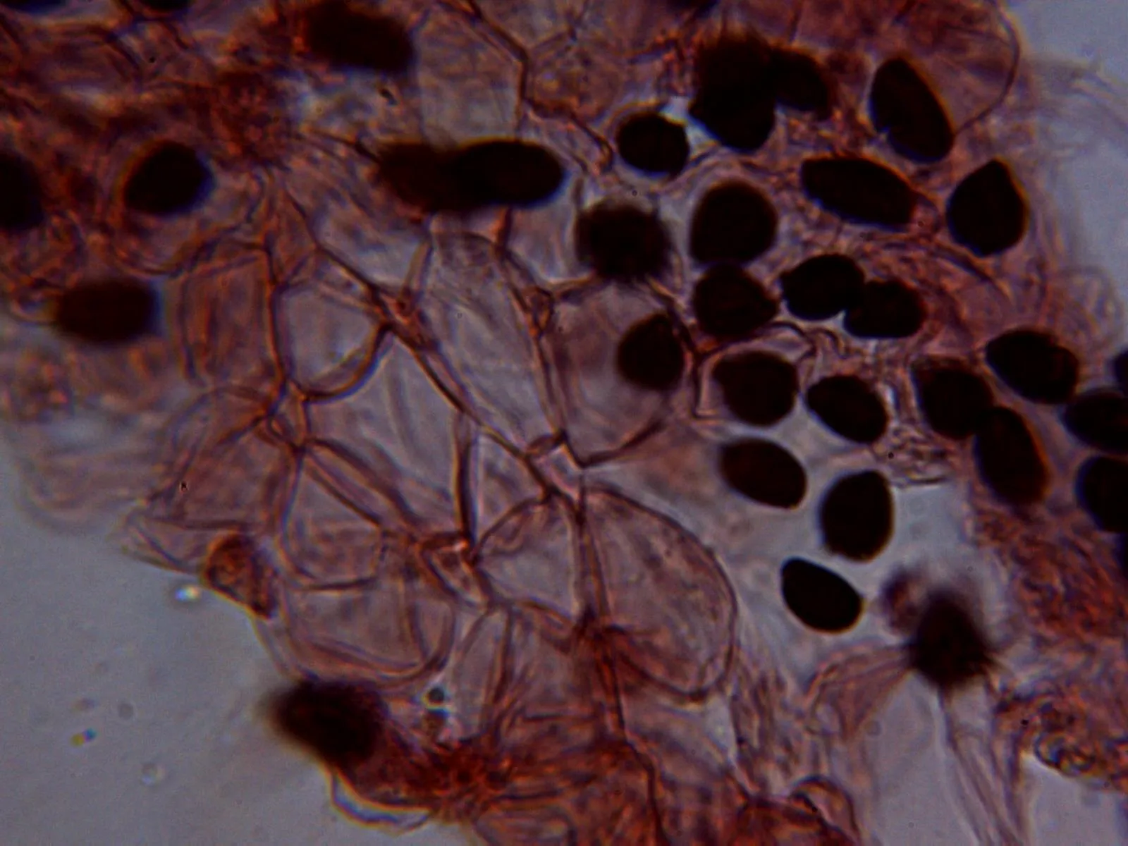 Microscopía de Parasola kuehneri - 10 - Pileipellis 1